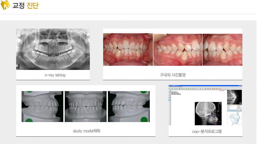 
1. X-ray taking 2.  Կ 3. study modelä 4. cep-мα׷